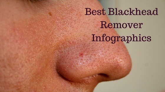 Best Blackhead Remover